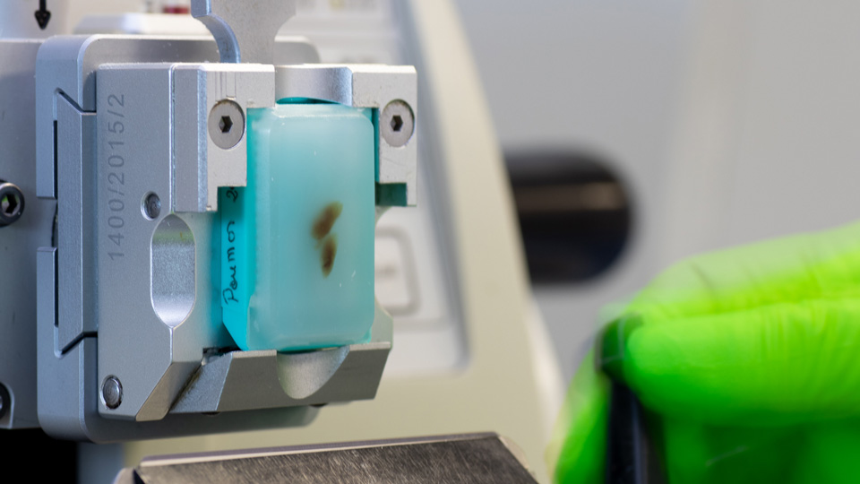 Confirming target-antigen expression in FFPE cohorts