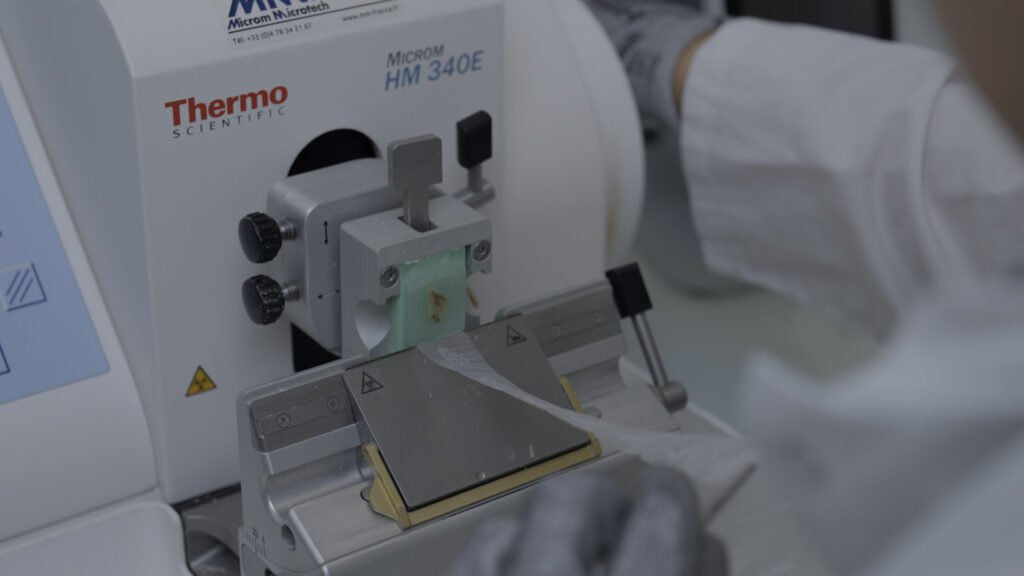 Custom FFPE tissue sourcing oncology CRO