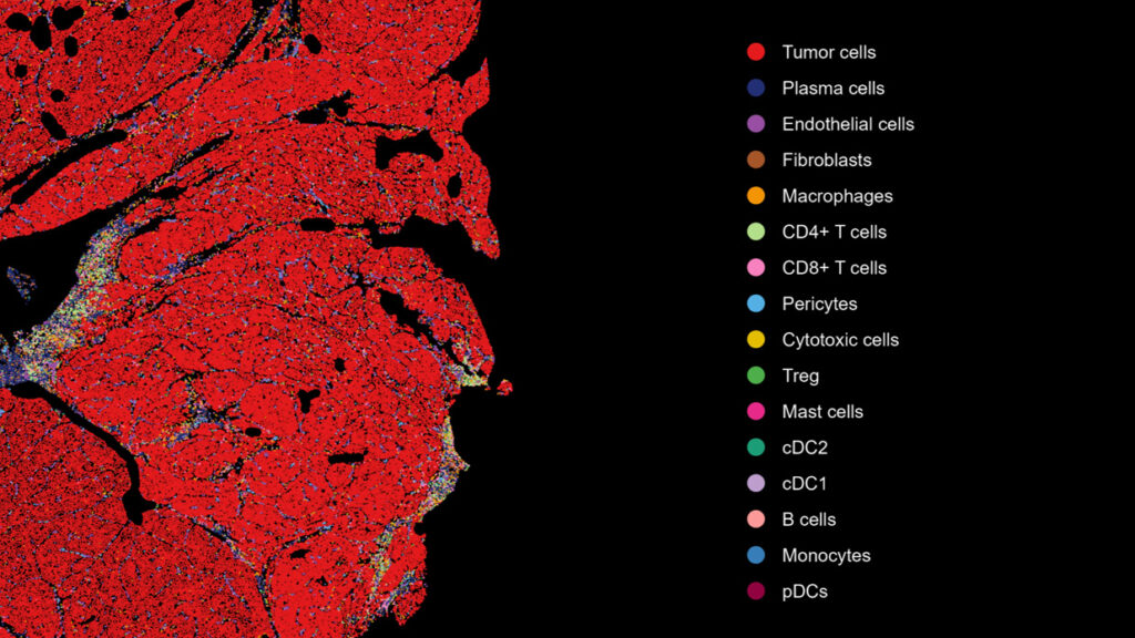 FFPE Transcriptomic profiling data science oncology target discovery