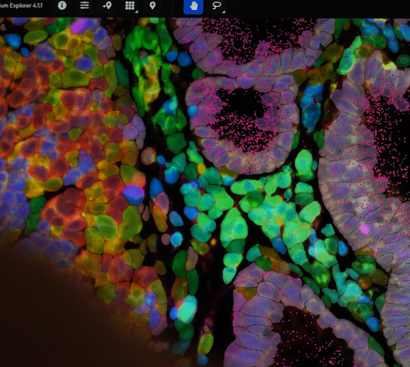 10x Genomics Data Analysis Services Chromium X, Visium HD, Xenium bioinformatics