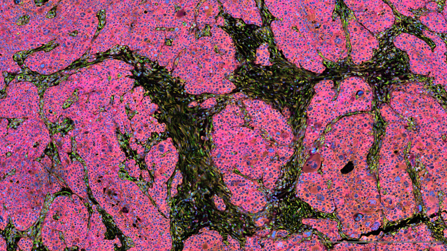 Analysis of 10x Genomics Xenium Single-Cell Transcriptomic Data