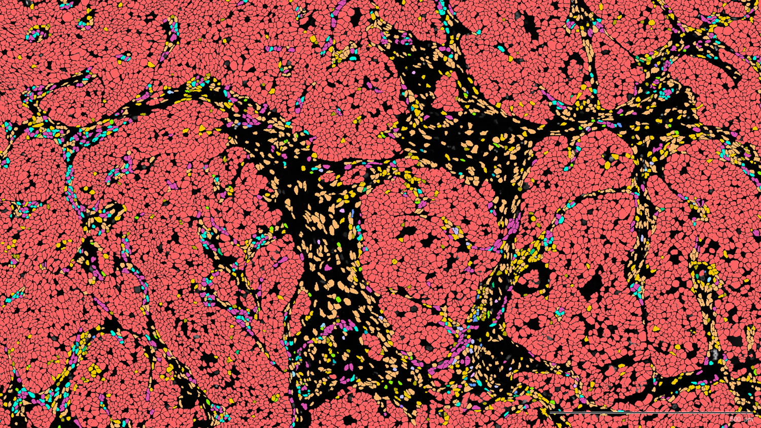 Bioinformatics Analysis of Xenium Single-Cell Transcriptomics Data