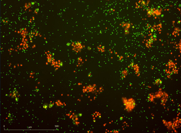 Killing after antigen-priming