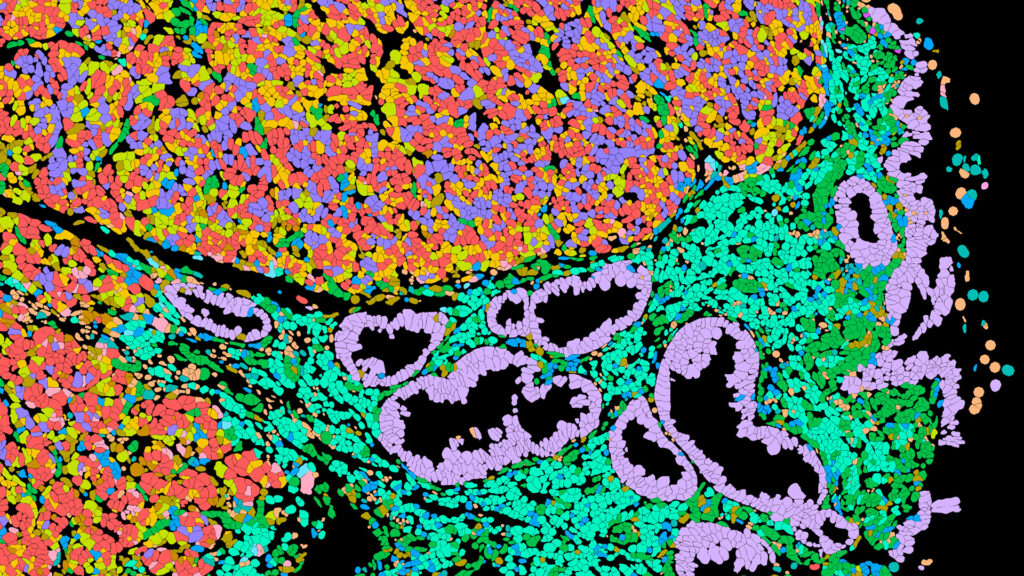 Data Science Services: Analyzing 10x Genomics datasets in 4 weeks