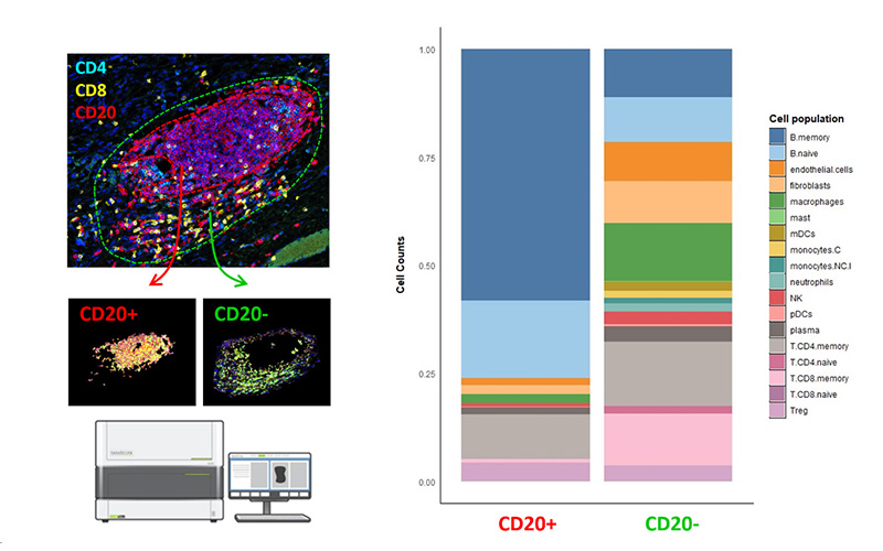 Estimation-of-immune-cell-composition-based-on-data-deconvolution-GeoMx-data-analysis