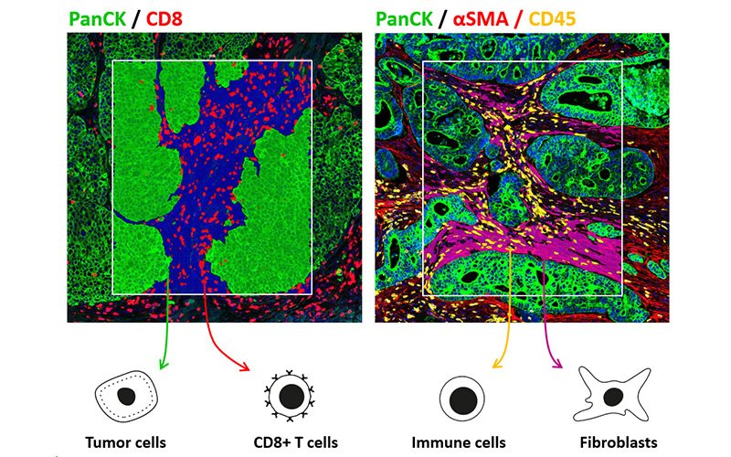 GEOMX-Nanostring-services-CRO-immuno-oncology-DSP