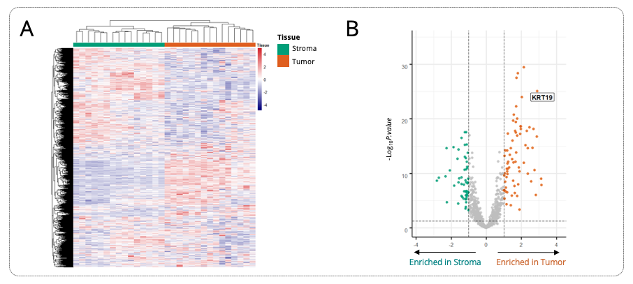 Heatmap view of the unsupervised clustering of 15 ROIs (divided in 15 AOIs in stroma and 15 AOIs in tumor)  according to the 1,800 genes expression profile