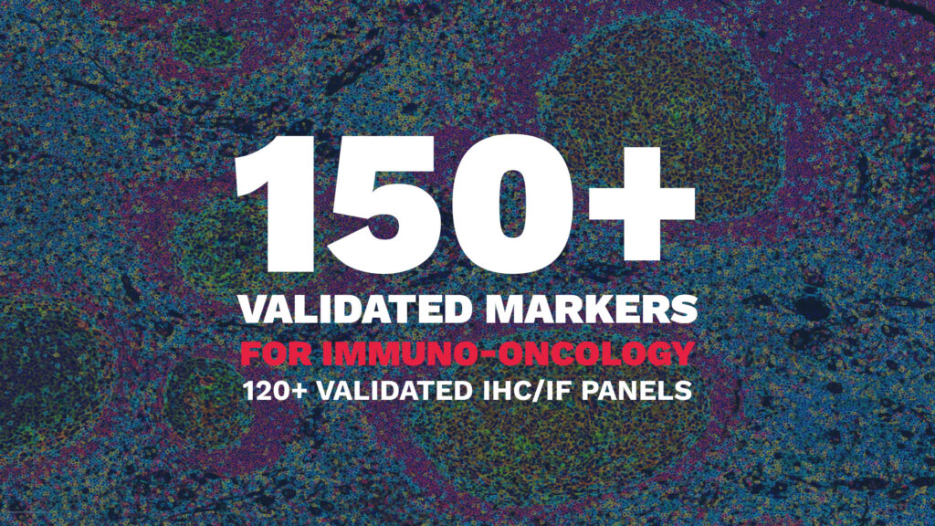Histology services (IHC/IHF) : 150 validated markers, 120+ panels for Immuno-Oncology