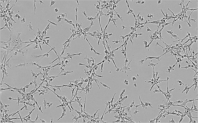 M1 macrophages