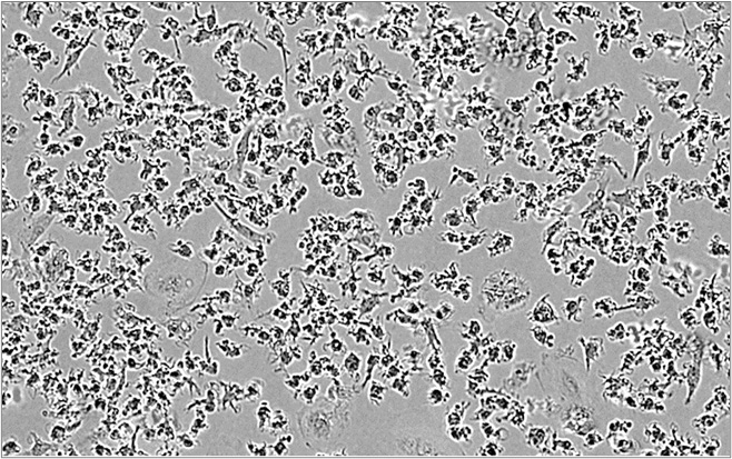 M2 macrophages