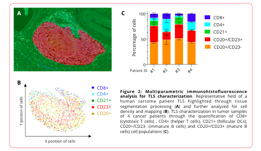 Multiparametric TLS characterization by digital pathology