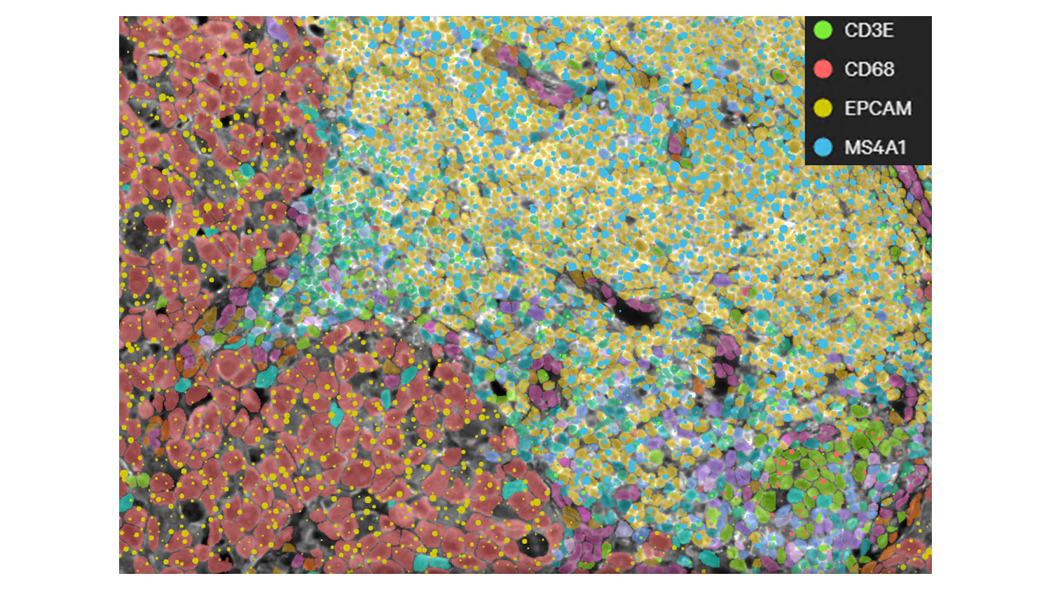 Single-Cell Gene Expression Analysis from Xenium Data