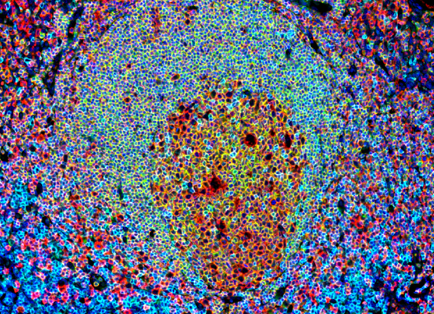Immunohistofluorescence field of a human tonsil section illustrating the germinal center in a lymphoid structure.