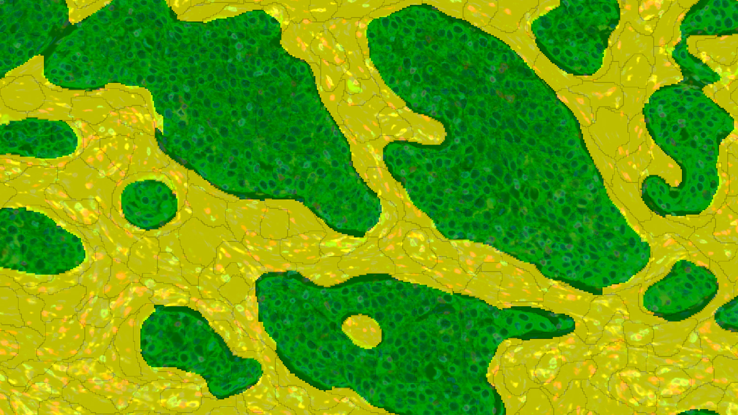 Tissue segmentation