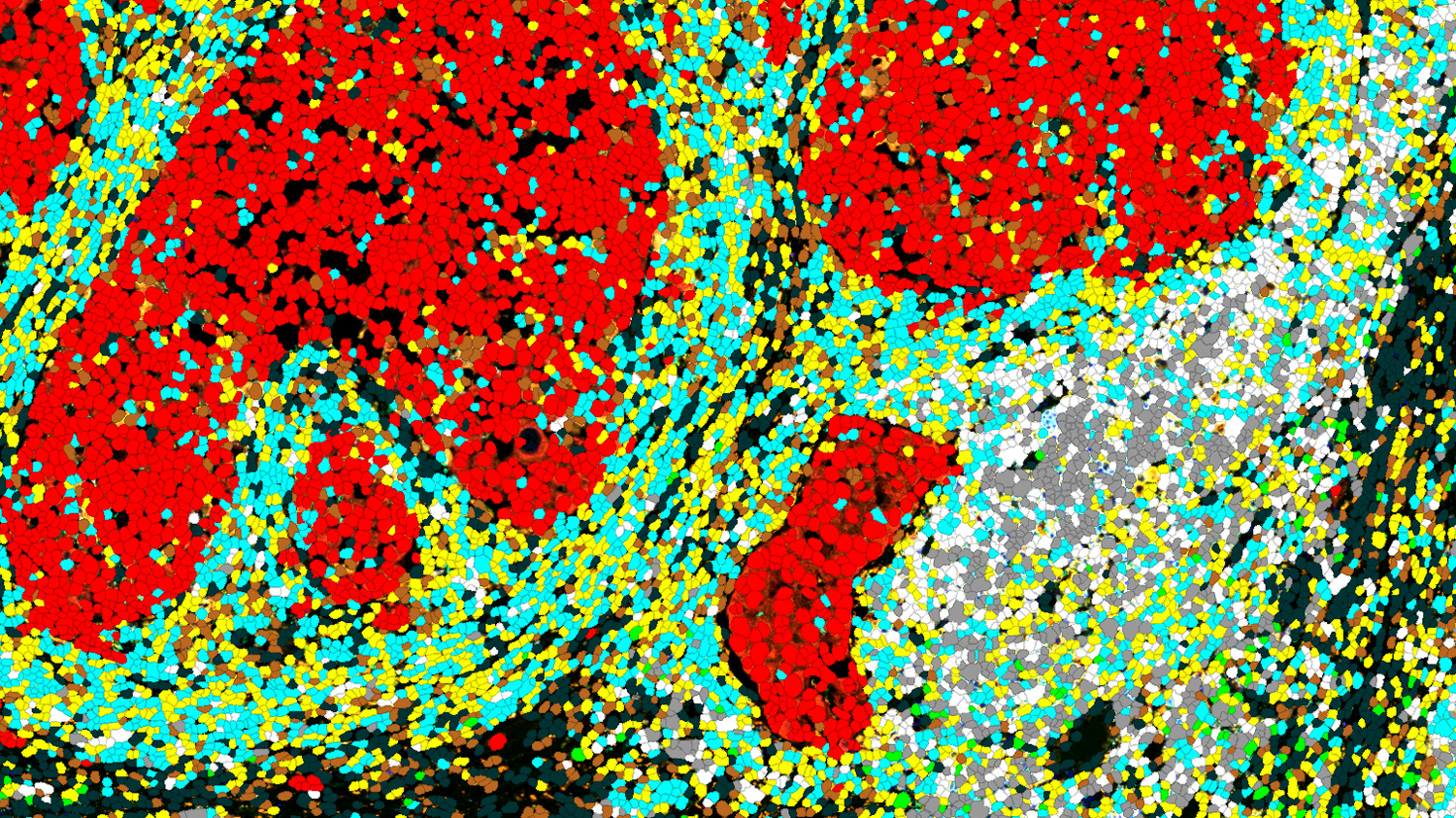 Cell segmentation