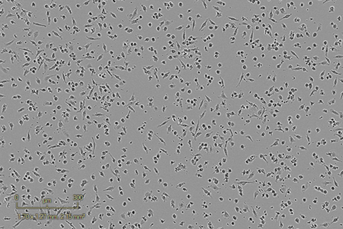 Control – Inactivated PBMCs