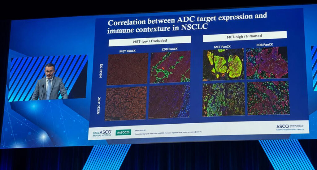 Analysis of spatial atlas of ADC targets in immunotherapy-treated NSCLC to link compartment-specific target expression with tumor immune contexture, clinical outcome, and on-treatment remodeling.