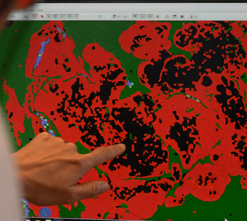 mIF & IHC Image Analysis Services for Digital Pathology