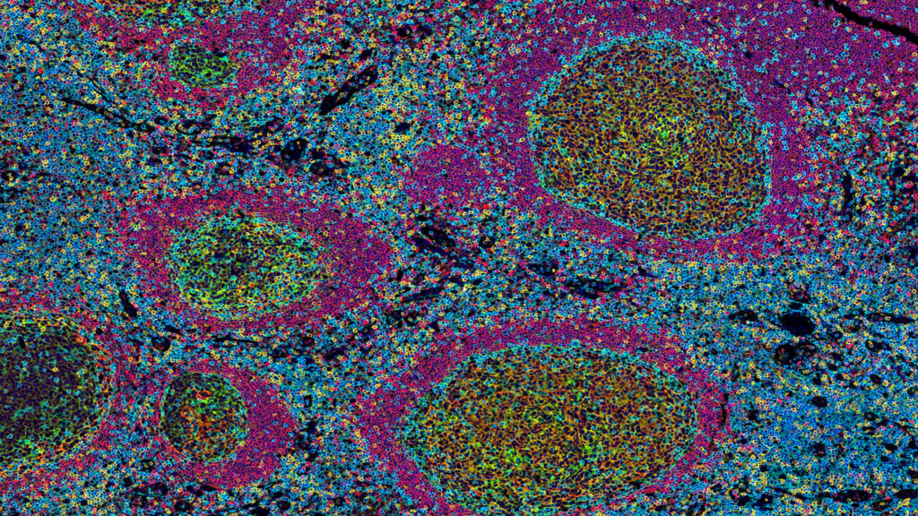 Translational Research in Cancer Immunotherapy: 5 Key Findings