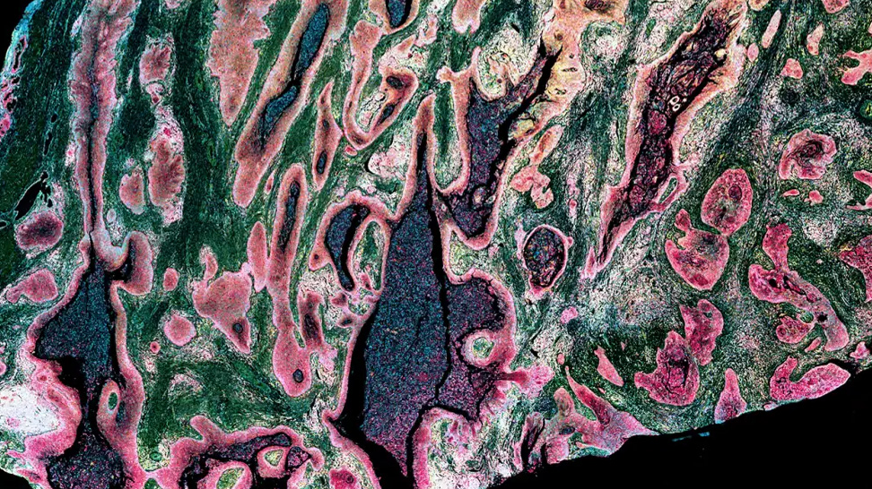Bioinformatics analysis of Atera whole-transcriptome spatial data