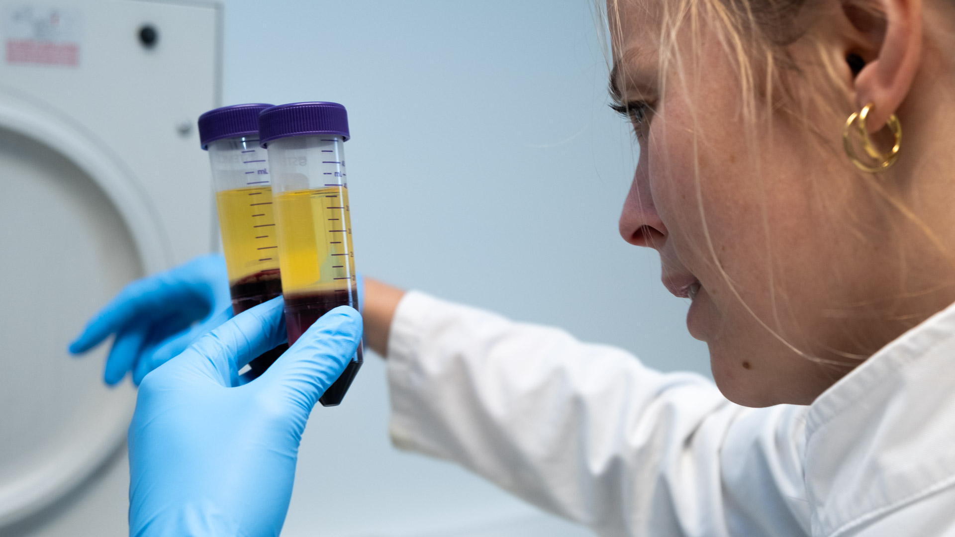 Explicyte technician preparing immune cells for multiplex flow cytometry