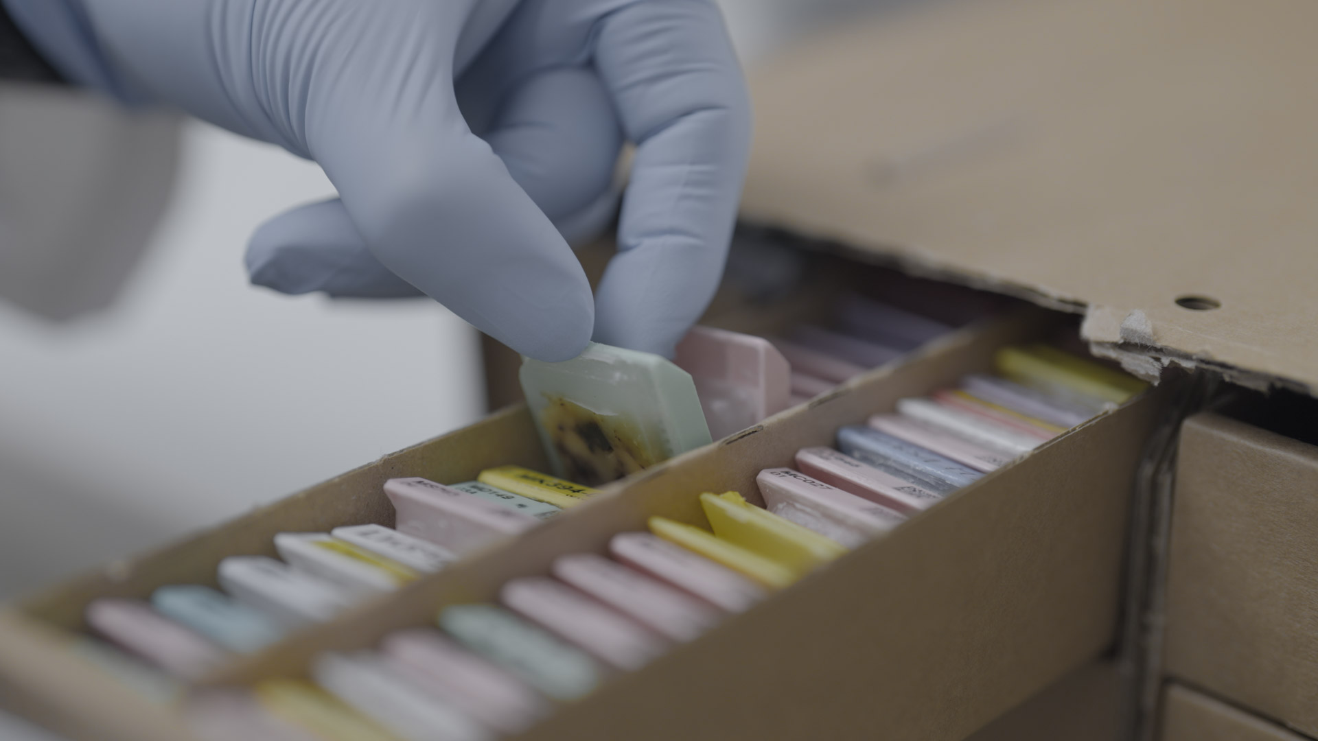 FFPE tumor tissue blocks prepared for 10x Genomics spatial and single-cell workflows at Explicyte's Bordeaux CRO