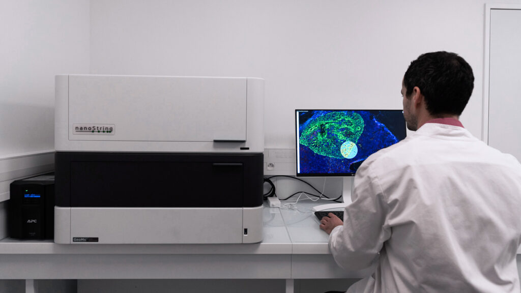 GeoMx spatial transcriptomics services