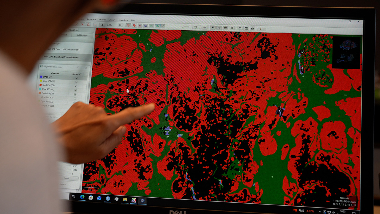 Quantitative digital pathology image analysis and interpretation