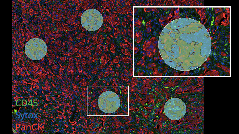 Staining, imaging, and region selection on GeoMx DSP