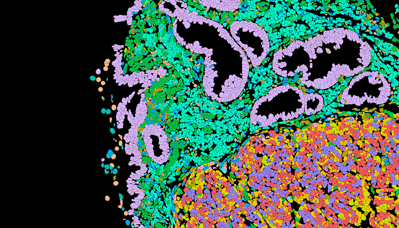 Bioinformatics Analysis of Xenium Single-Cell Transcriptomics Data