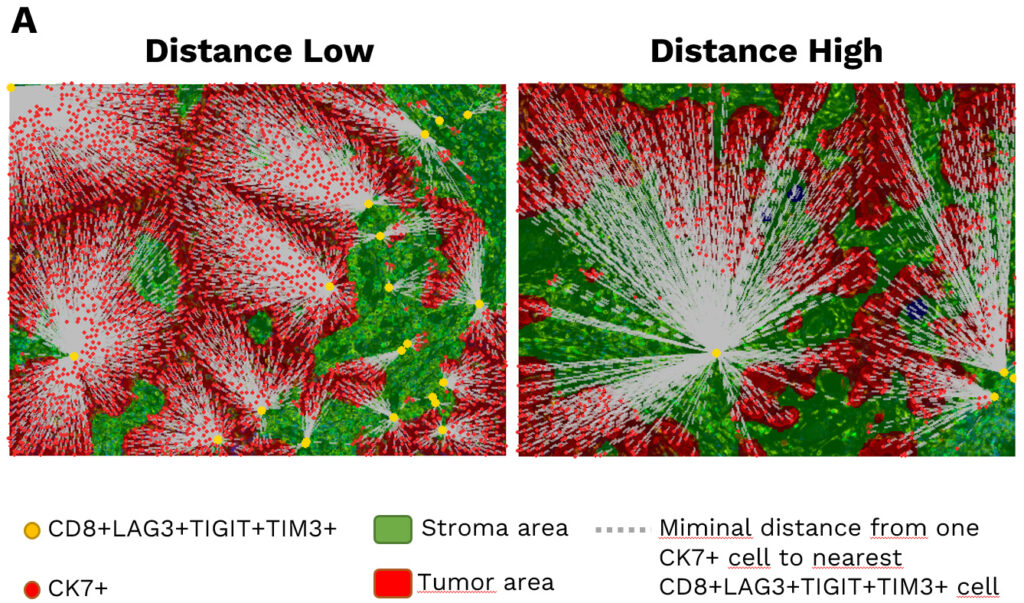Spatial analysis measures how exhausted T cells are organized around tumor cells