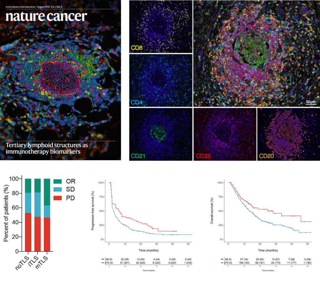 Mature-TLS-predictive-biomarker-cancer-immunotherapy