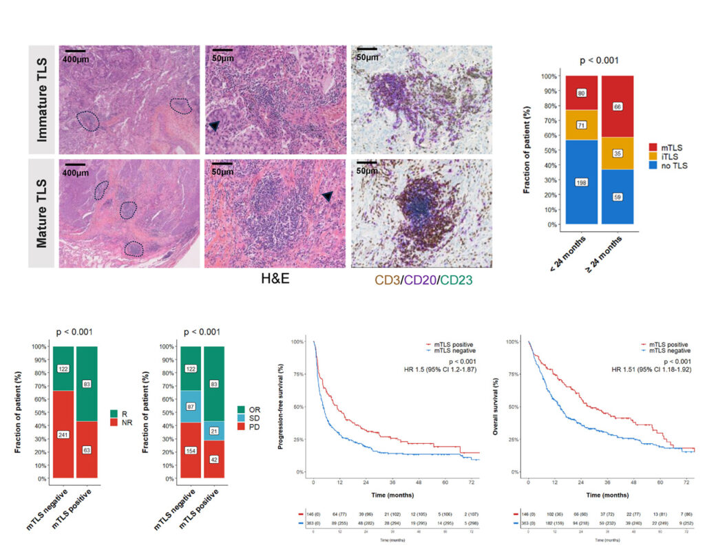 Mature TLS remained associated with ICI outcome in a 509-patient NSCLC cohort