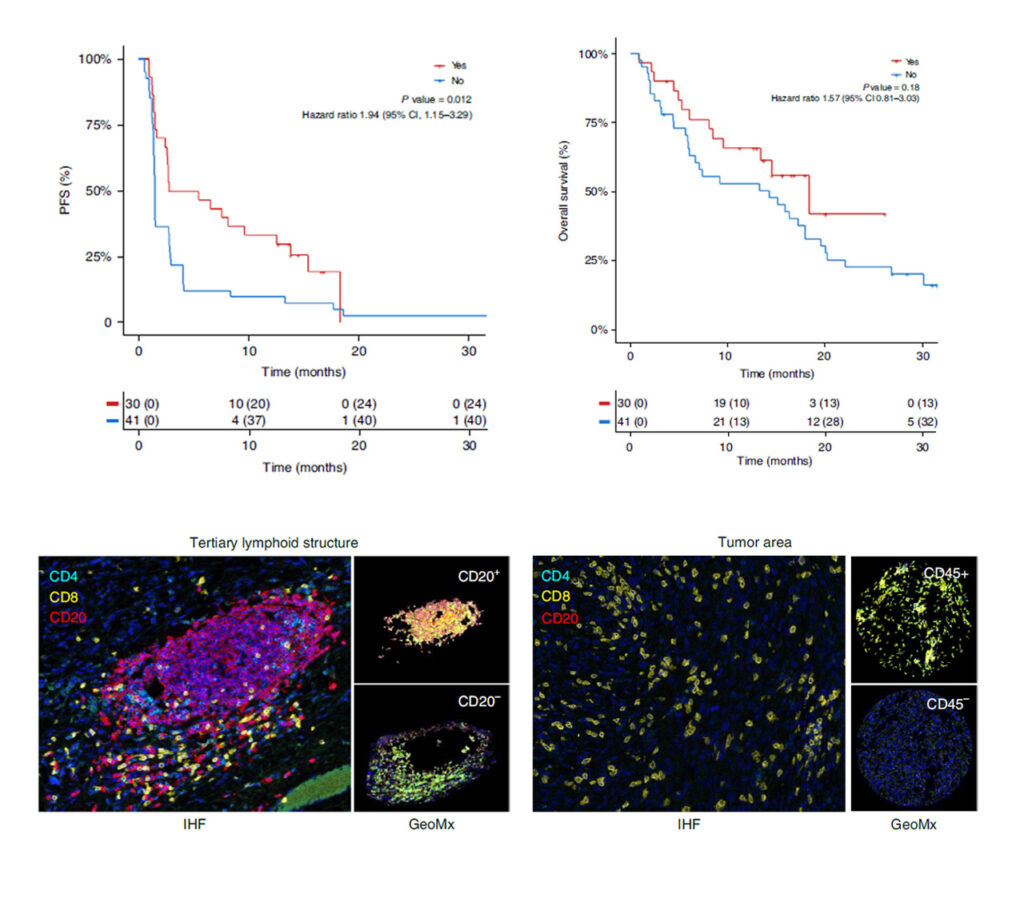 TLS-based selection was prospectively evaluated in a phase 2 sarcoma cohort
