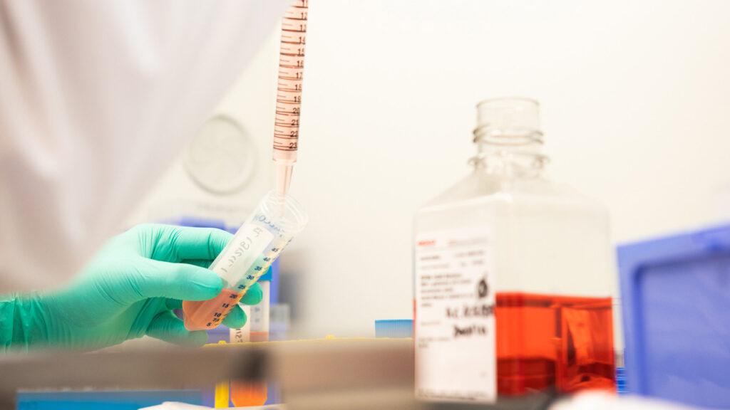 Targeted metabolites & immunometabolism biomarker analysis
