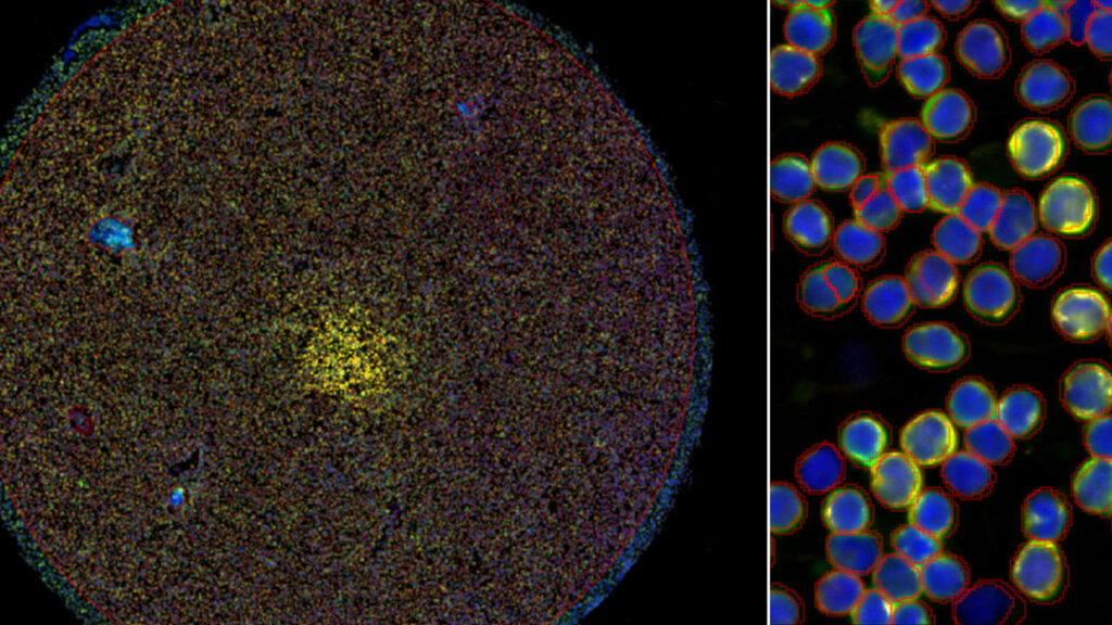 Fixed dissociated cells profiled using the Xenium STAMP workflow